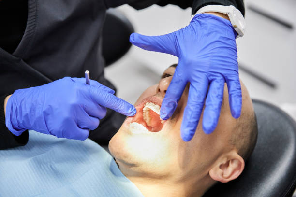 Best Emergency Tooth Extraction in West Point, MS